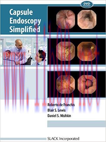 [PDF]Capsule Endoscopy Simplified