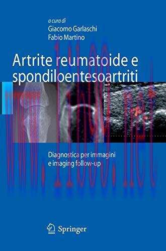 [AME]Artrite reumatoide e spondiloentesoartriti: Diagnostica Per Immagini Ed Imaging Follow-Up ...
