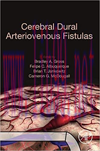 [PDF]Cerebral Dural Arteriovenous Fistulas 1st Edition