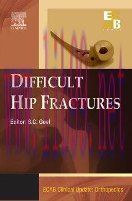 [AME]Difficult Hip Fracture - ECAB