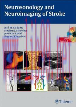 [AME]Neurosonology and Neuroimaging of Stroke