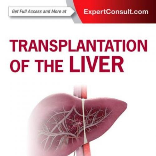 Transplantation of the Liver, 3rd Edition - Wei Zhi