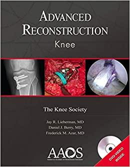 (PDF)Advanced Reconstruction Knee Reprint Edition