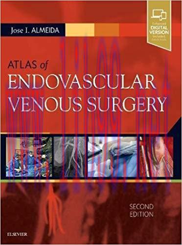 [AME]Atlas of Endovascular Venous Surgery, 2nd Edition (PDF)