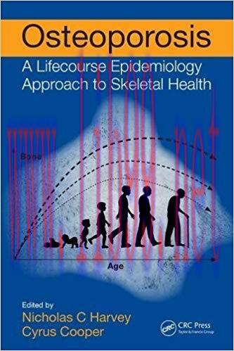 [PDF]Osteoporosis: A Lifecourse Epidemiology Approach to Skeletal Health