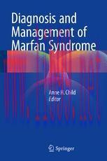 [PDF]Diagnosis and Management of Marfan Syndrome