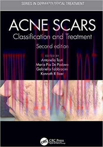 [PDF]Acne Scars: Classification and Treatment