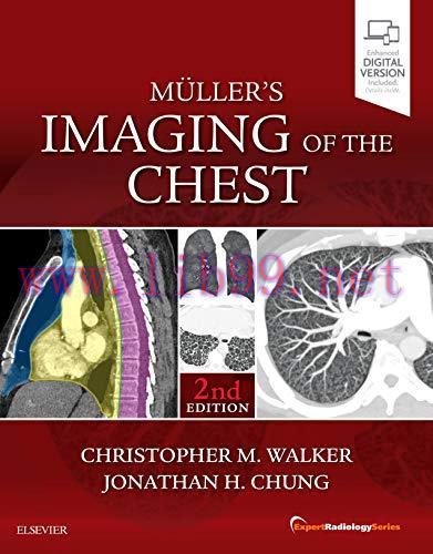 [AME]Muller's Imaging of the Chest: Expert Radiology Series, 2ed (PDF)