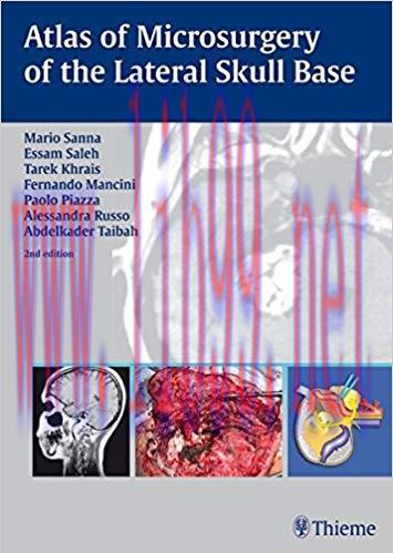 [PDF]Atlas of Microsurgery of the Lateral Skull Base, 2e [Thieme] [2007]