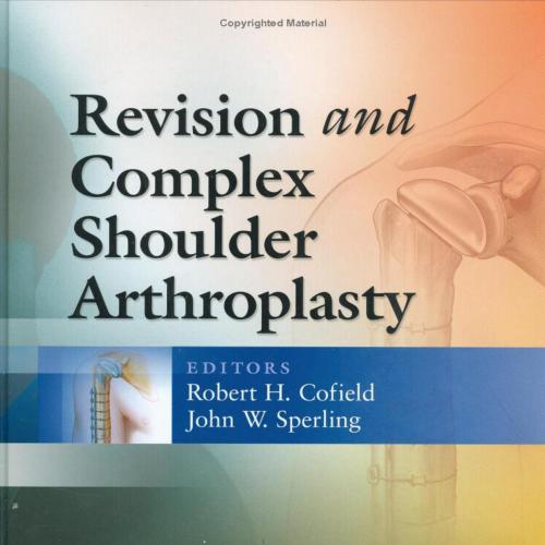 Revision and Complex Shoulder Arthroplasty - emacuser