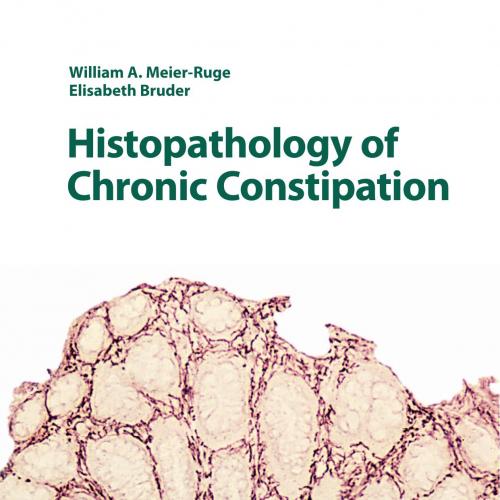 Histopathology of Chronic Constipation
