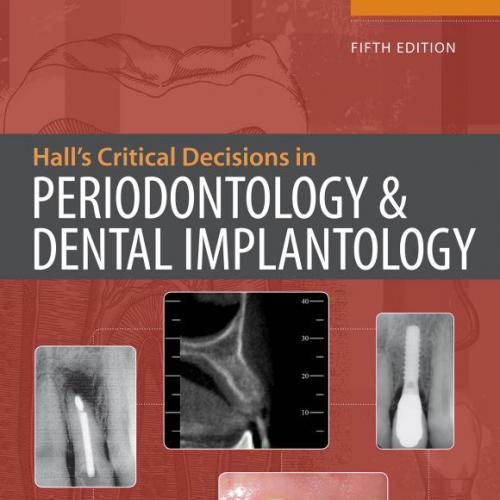 Hall&rsquo;s Critical Decisions in Periodontology 5th Edition