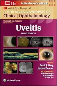 [AME]Uveitis: Color Atlas and Synopsis of Clinical Ophthalmology (Wills Eye Institute Atlas Ser...