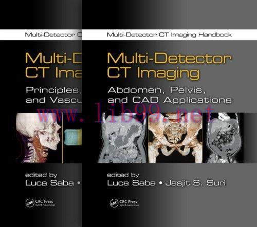 [AME]Multi-Detector CT Imaging Handbook, Two Volume Set (Original PDF)