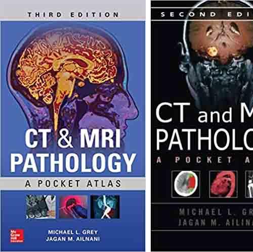CT and MRI Pathology A Pocket Atlas, 3rd Edition + 2e