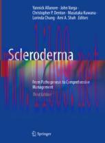 [PDF]Scleroderma: From_ Pathogenesis to Comprehensive Management