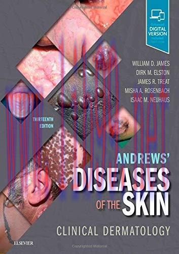 [AME]Andrews&rsquo; Diseases of the Skin: Clinical Dermatology, 13ed (Original PDF)