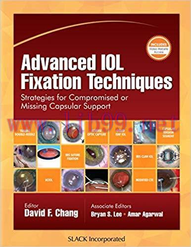 [PDF]Advanced IOL Fixation Techniques strategies for compromised or missing capsular support