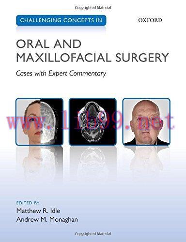 [AME]Challenging Concepts in Oral and Maxillofacial Surgery: Cases with Expert Commentary (PDF)