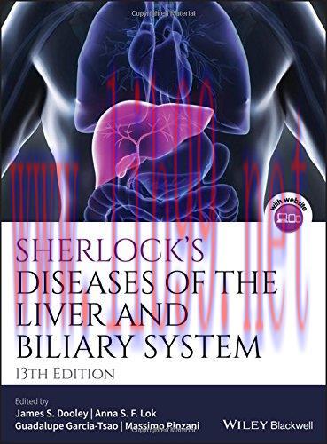 [AME]Sherlock&rsquo;s Diseases of the Liver and Biliary System, 13ed (PDF)