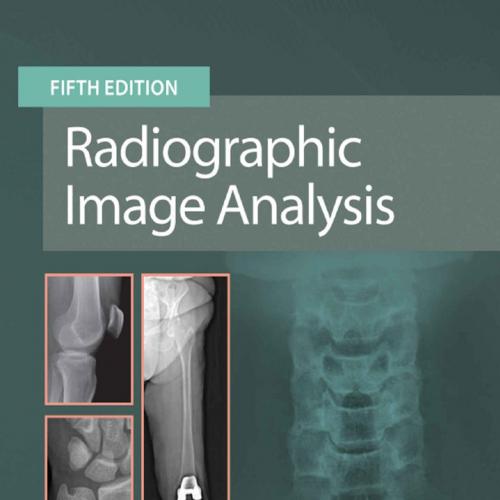 Radiographic Image Analysis 5th Edition