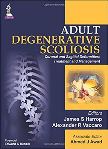 Adult Degenerative Scoliosis