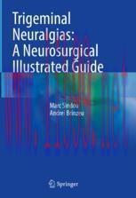 [PDF]Trigeminal Neuralgias: A Neurosurgical Illustrated Guide