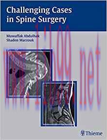 [PDF]Challenging Cases in Spine Surgery