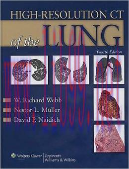 [AME]High-Resolution CT of the Lung, 4th Edition (ORIGINAL PDF from_ Publisher)