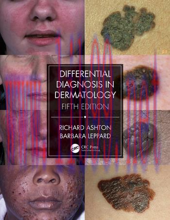 [AME]Differential Diagnosis in Dermatology, 5th Edition (Original PDF)