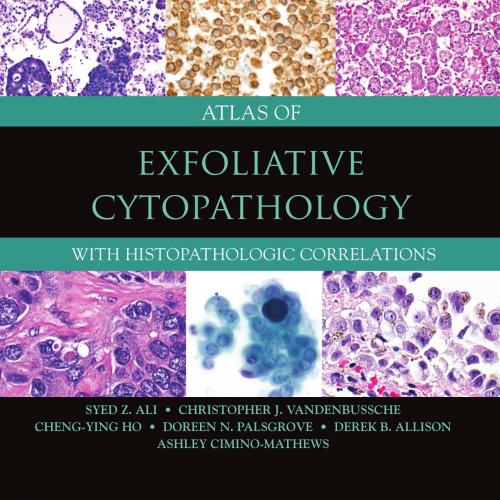 Atlas of Exfoliative Cytopathology With Histopathologic Correlations - Syed Z. Ali