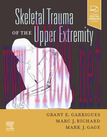 [AME]Skeletal Trauma of the Upper Extremity (EPUB)