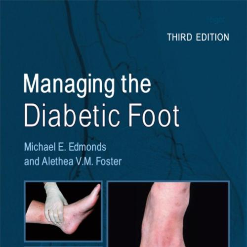 Managing the Diabetic Foot
