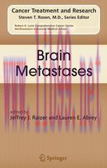 [PDF]Brain Metastases