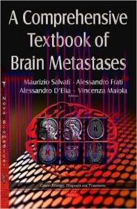 [AME]A Comprehensive Textbook of Brain Metastases