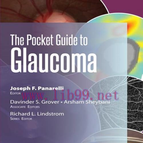[AME]The Pocket Guide to Glaucoma (EPUB)