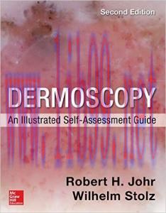 [AME]Dermoscopy: An Illustrated Self-Assessment Guide, 2nd Edition (EPUB)
