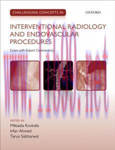 [AME]Challenging Concepts in Interventional Radiology