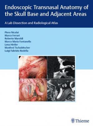 [AME]Endoscopic Transnasal Anatomy of the Skull Base and Adjacent Areas: A Lab Dissection and R...