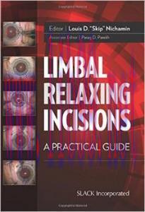 [AME]Limbal Relaxing Incisions: A Practical Guide