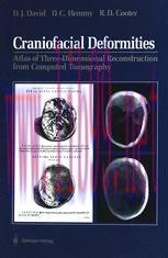 [PDF]Craniofacial Deformities: Atlas of Three-Dimensional Reconstruction from_ Computed Tomogra...
