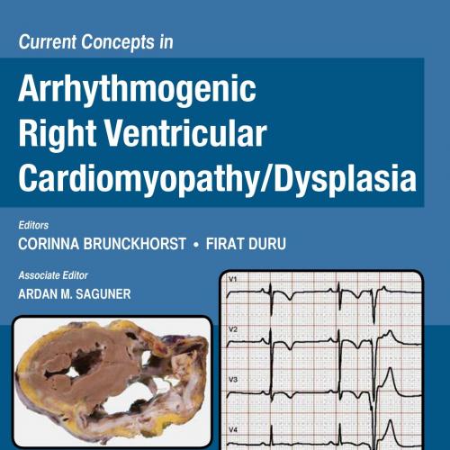 Current Concepts in Arrhythmogenic Right Ventricular Cardiomyopathy Dysplasia