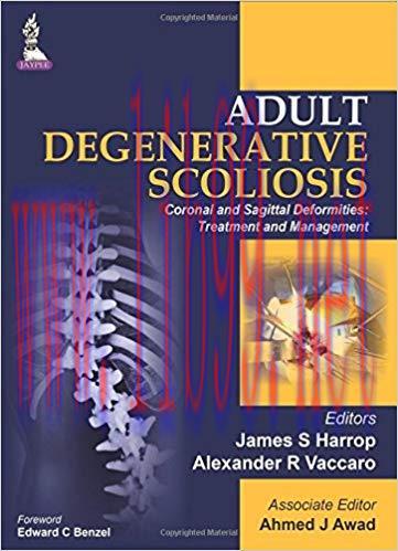 [PDF]Adult Degenerative Scoliosis