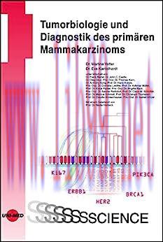 [AME]Tumorbiologie und Diagnostik des prim&auml;ren Mammakarzinoms (UNI-MED Science) (German Edition...