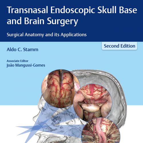 Thieme_ Transnasal Endoscopic Skull Base and Brain Surgery - Stamm, Aldo C.; Joao Mangussi-Gome...
