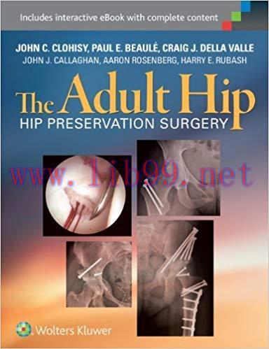 [PDF]The Adult Hip - Hip Preservation Surgery, 3rd Edition