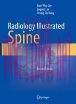 [PDF]Radiology Illustrated: Spine