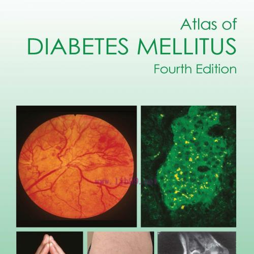 [AME]Atlas of Diabetes Mellitus, 4th Edition (EPUB)