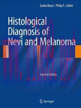 [AME]Histological Diagnosis of Nevi and Melanoma