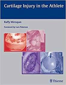 Cartilage Injury in the Athlete